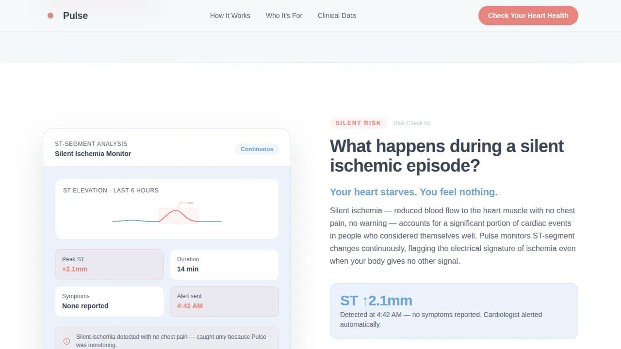 Rhythm — Smart Cardiac Health Landing Page Template