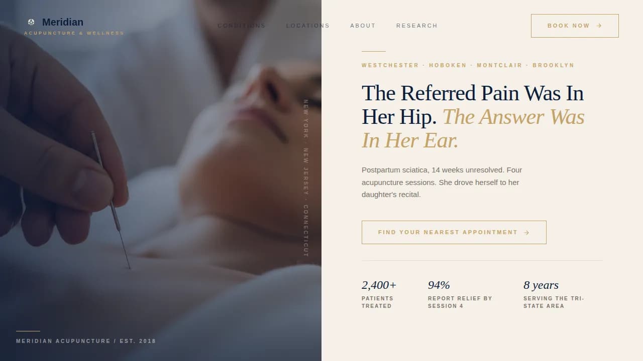 Acupoint — Proven Acupuncture Clinic Landing Page Template Template ...