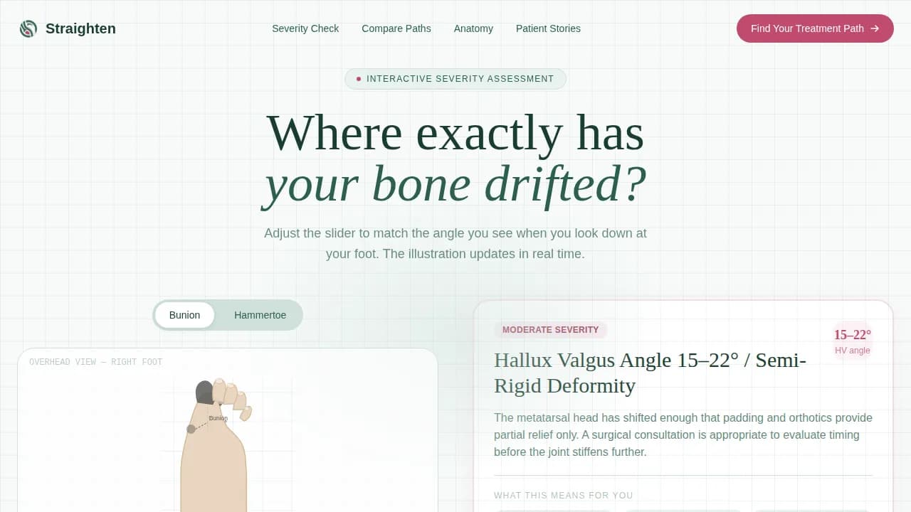 Align — Specialist Foot Care Landing Page Template