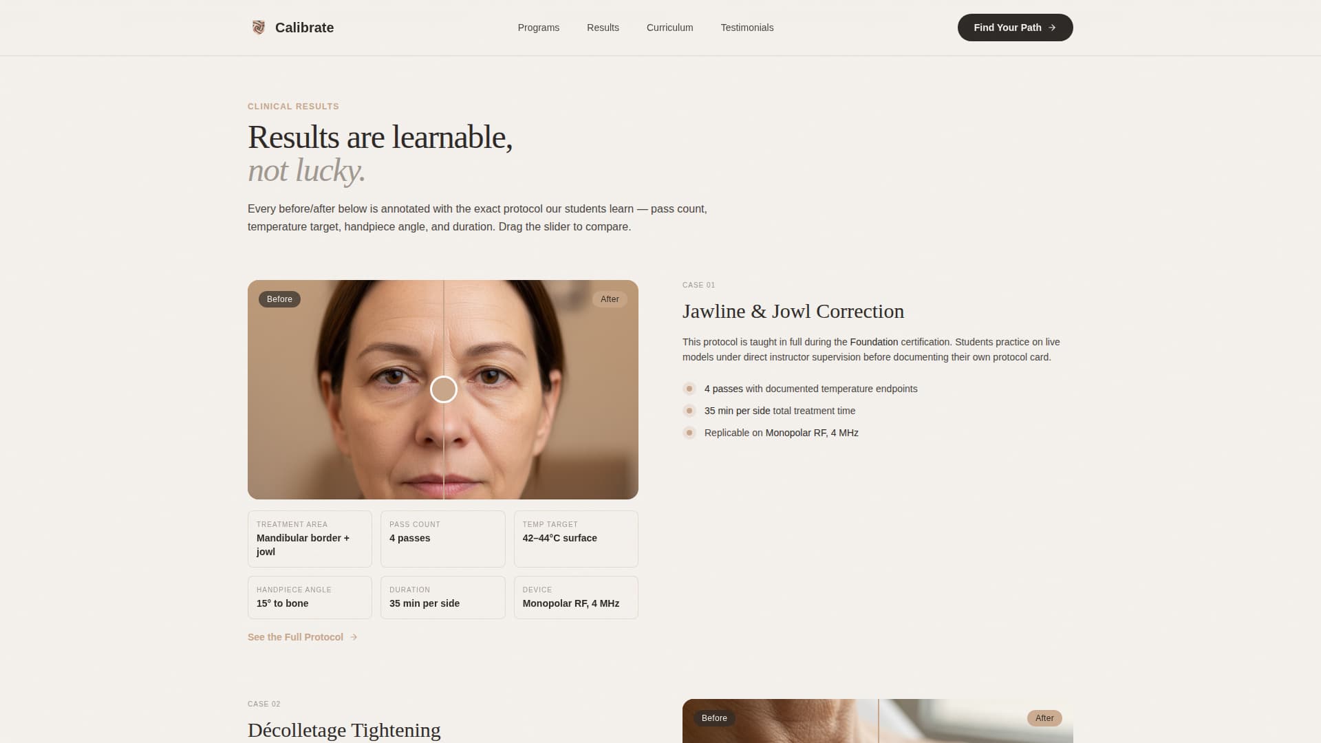 Calibrate - Precision Aesthetics Landing Page Template