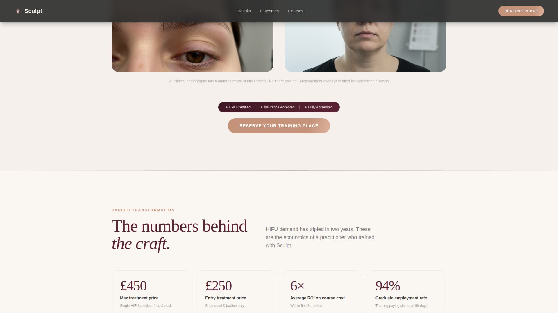 Sculpt - Precision Hifu Landing Page Template