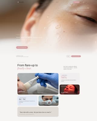 Clear - Radiant Acneclinic Landing Page Template