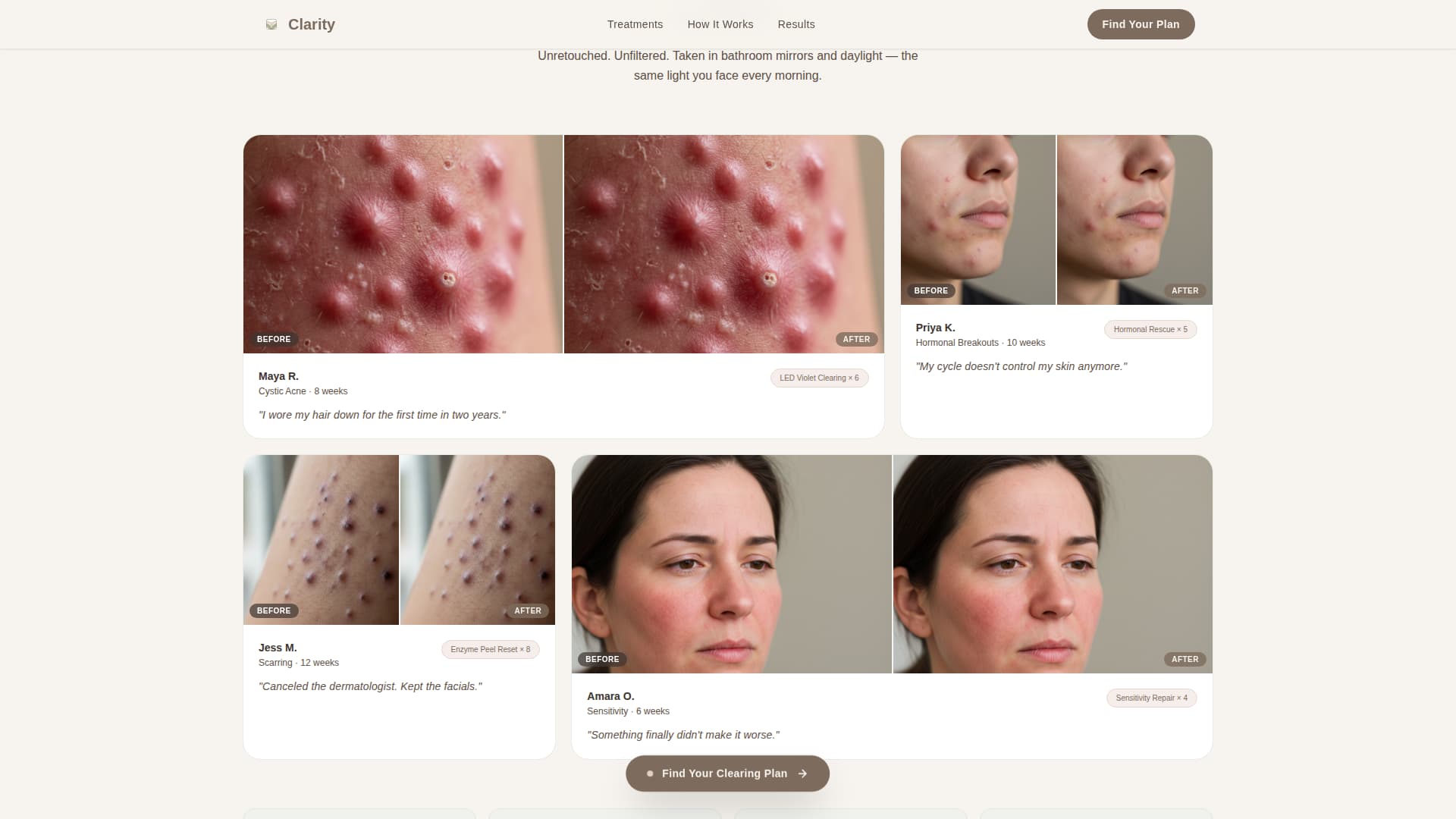 Clarity - Soothing Acnetreatment Landing Page Template