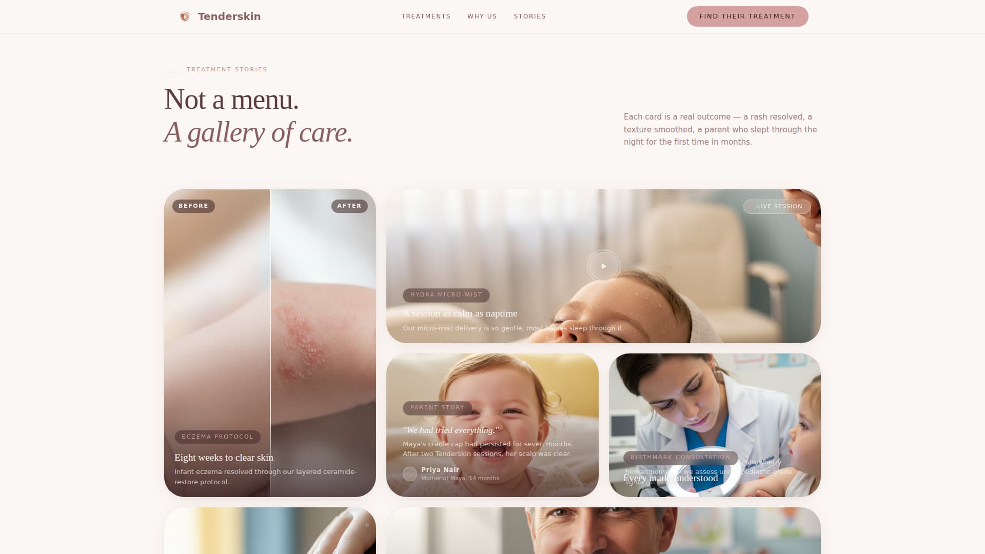 Tenderskin - Gentle Pediatricskincare Landing Page Template