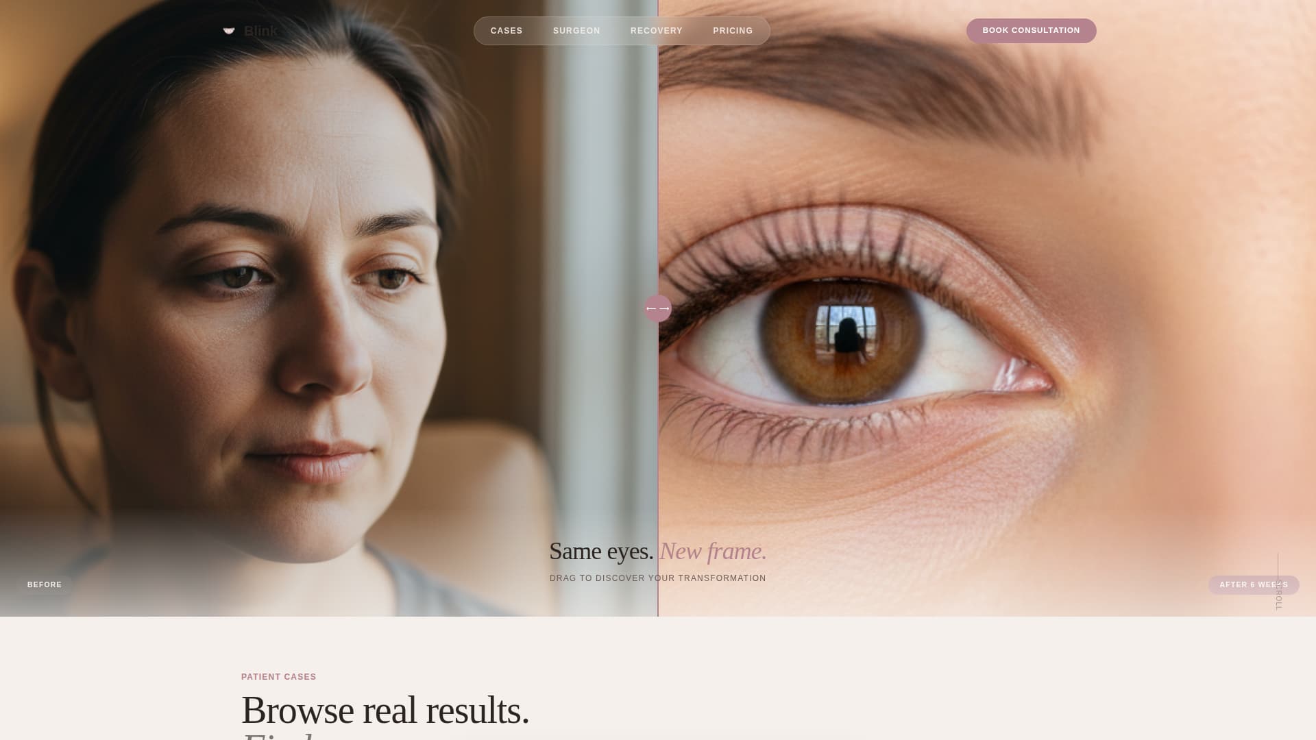 Blink - Transformative Blepharoplasty Landing Page Template