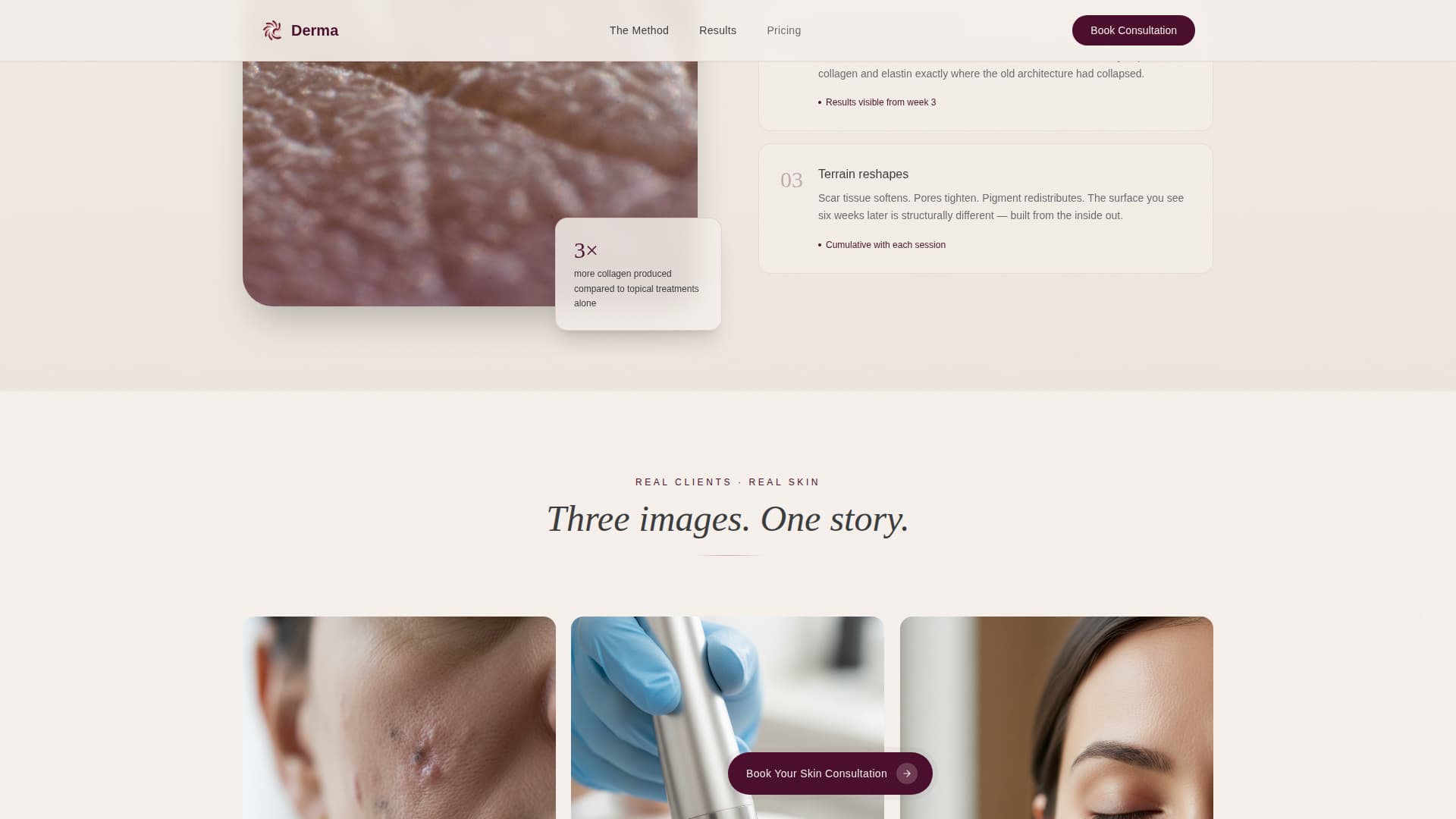 Derma - Transformative Microneedling Landing Page Template