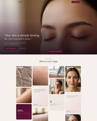 Derma - Transformative Microneedling Landing Page Template