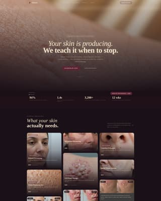 Sebum - Radiant Dermatologist Landing Page Template