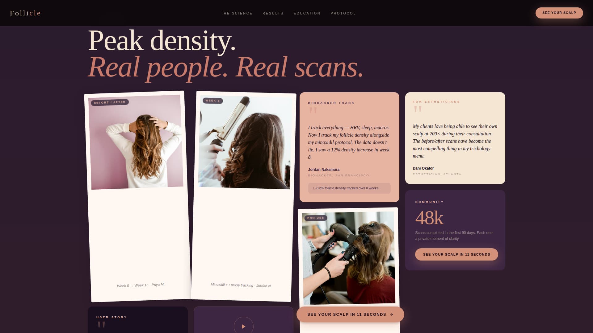 Follicle - Intimate Scalpanalyzer Landing Page Template