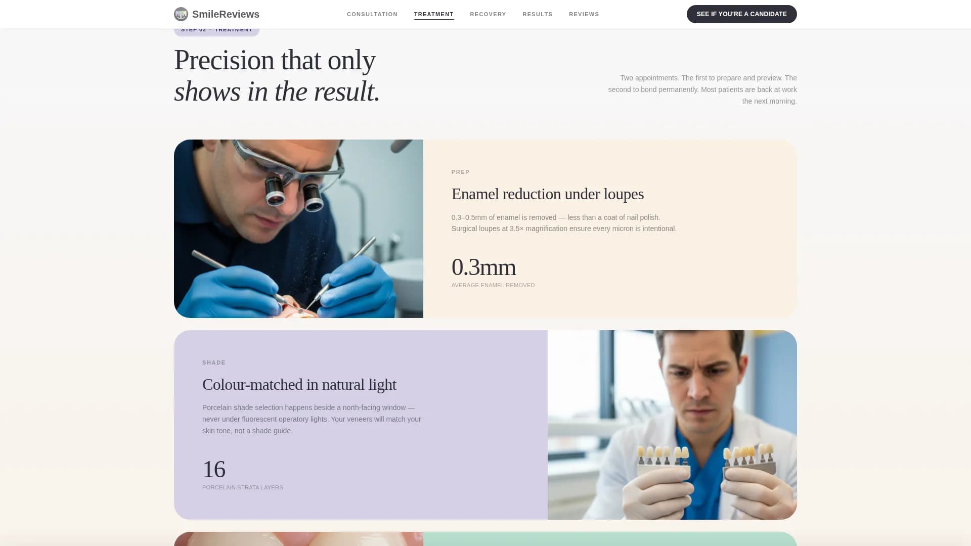 Smile - Veneer Services Landing page Template