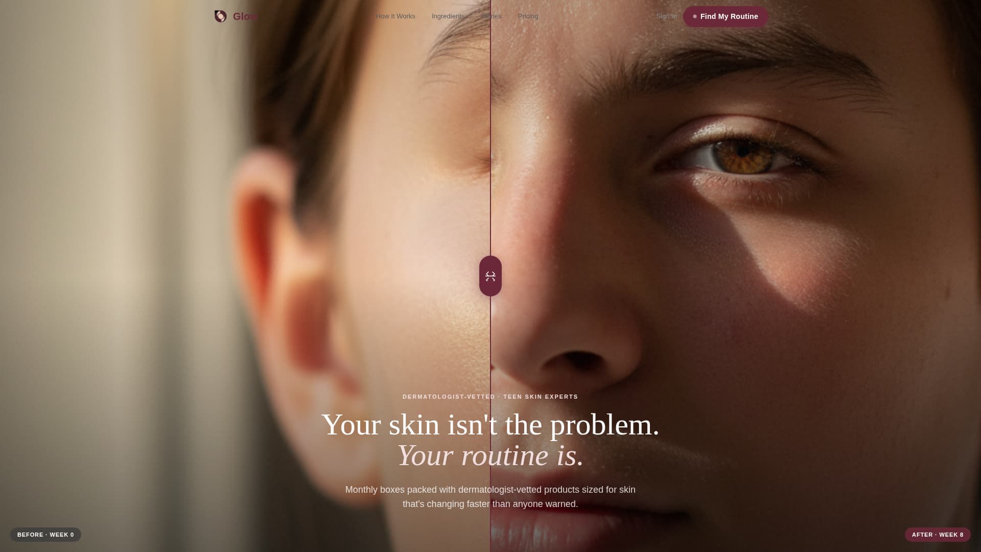 Glow - Radiant Teenskin Landing Page Template