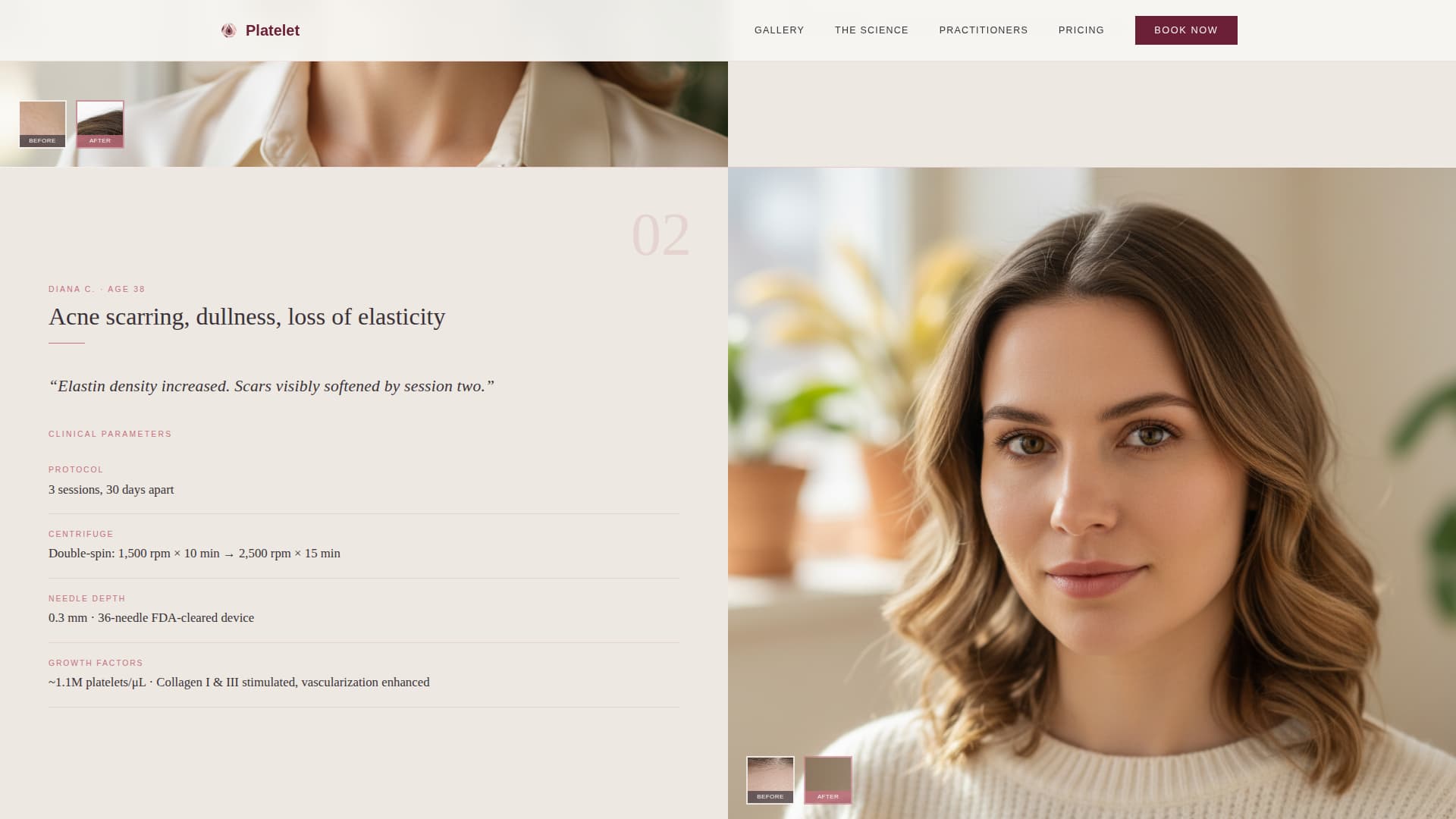 Platelet - Transformative Prp Landing Page Template