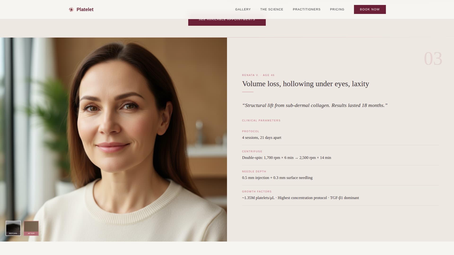 Platelet - Transformative Prp Landing Page Template
