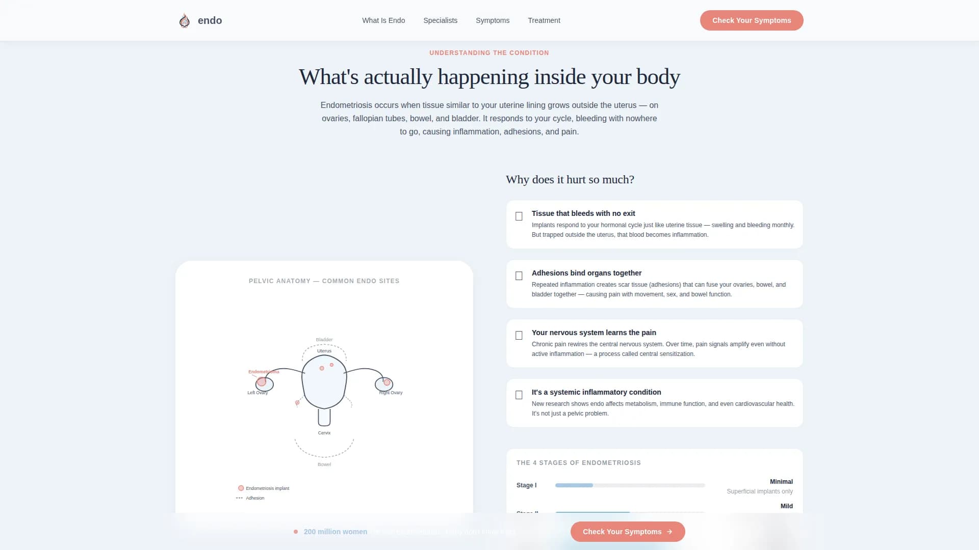 Endometriosis Care Education Website Template