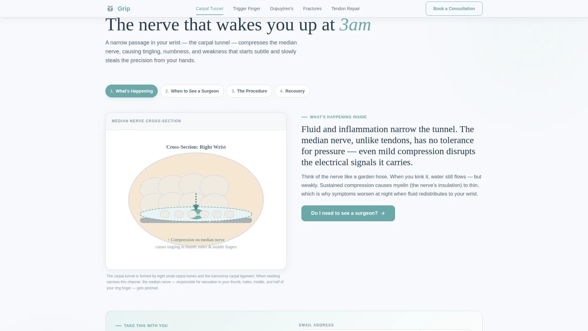 Suture - Patient Education Landing Page Template