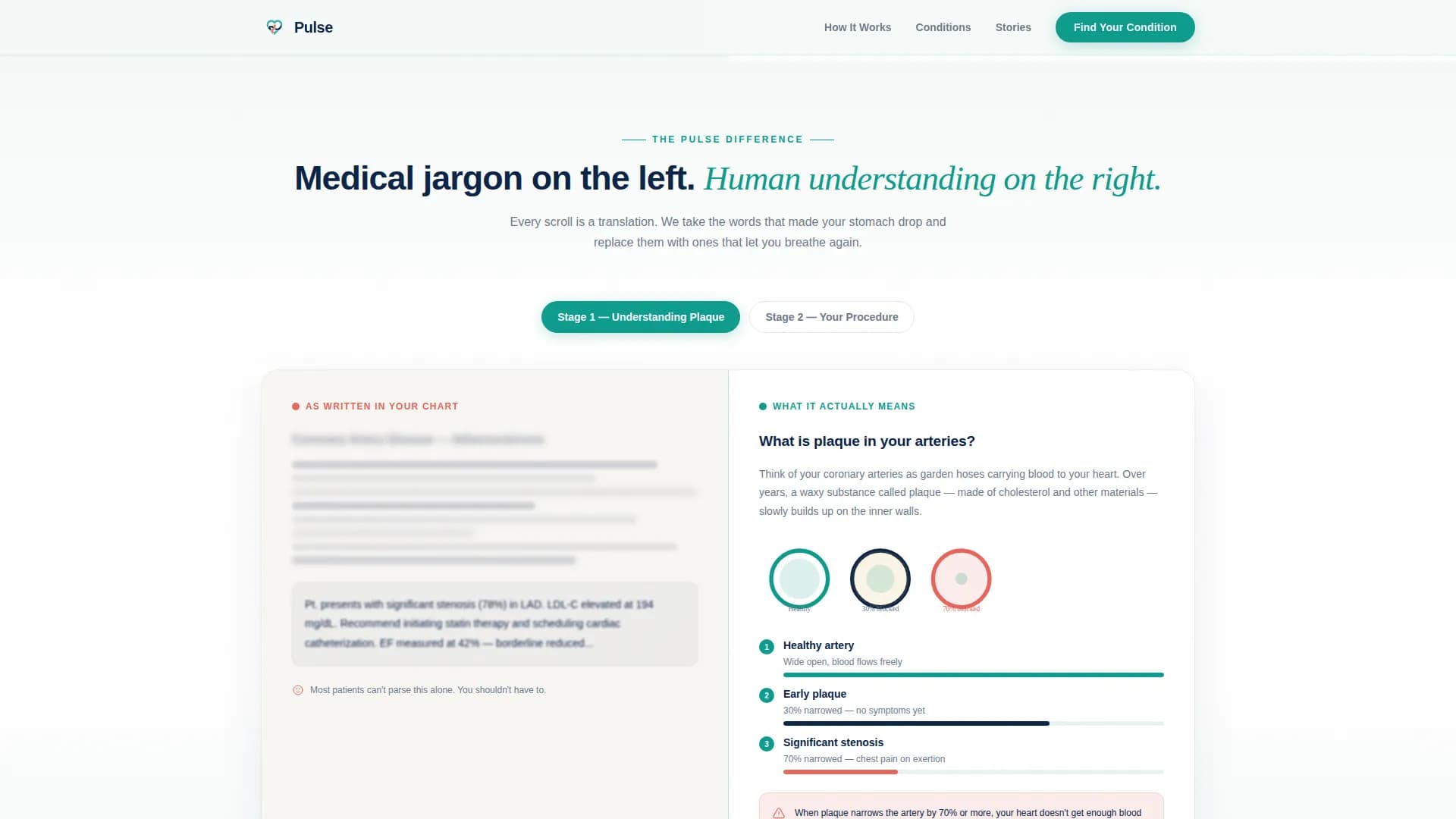 Pulse - Trust Cardiology Landing page Template