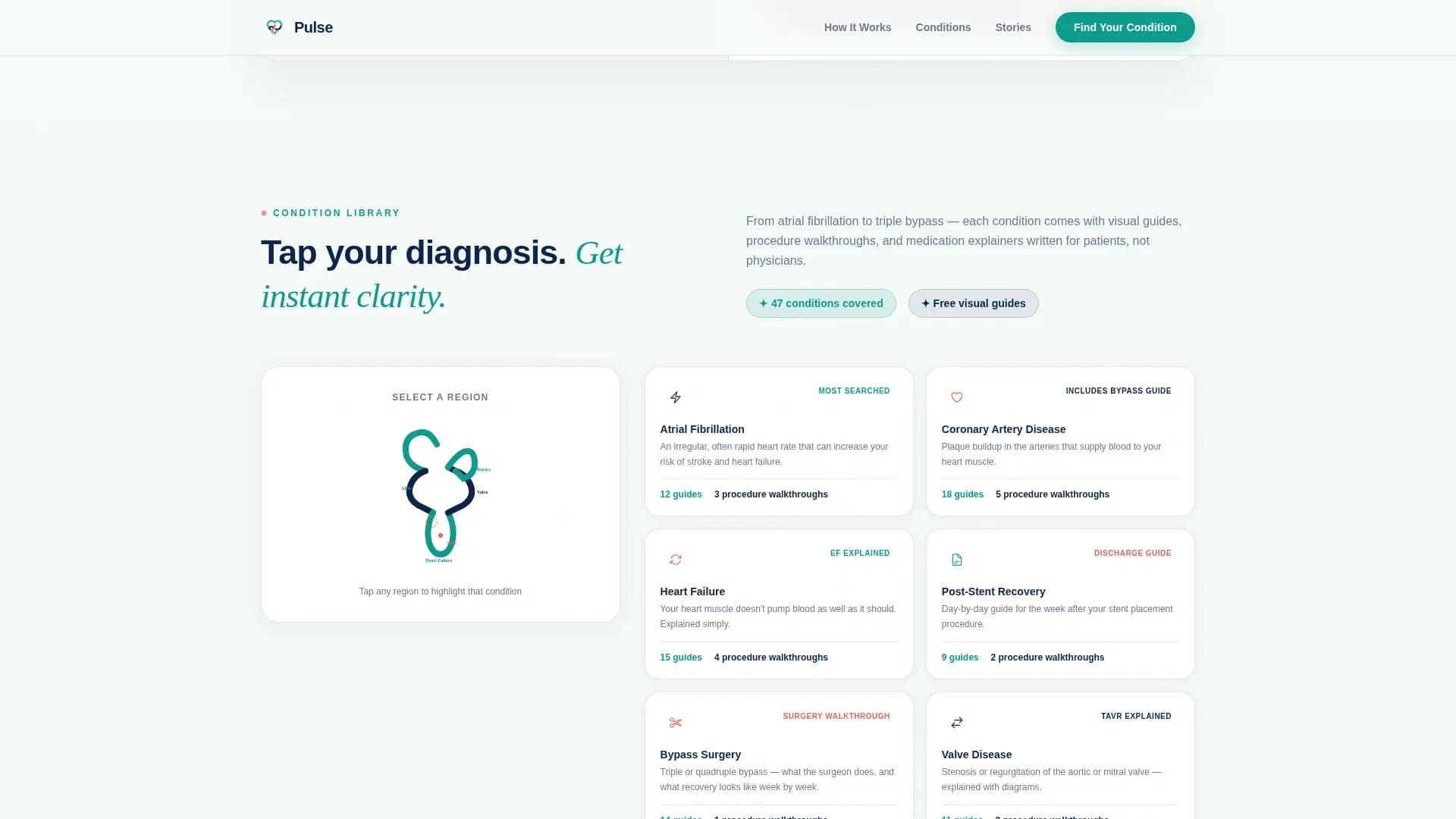 Pulse - Trust Cardiology Landing page Template