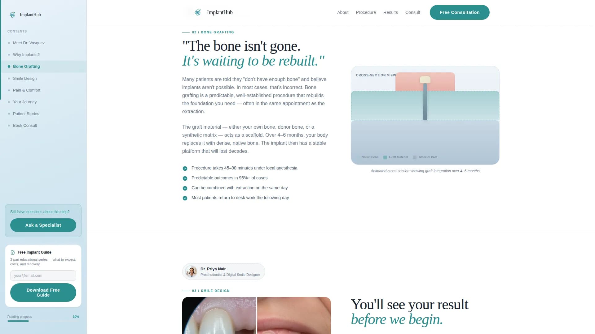 Implant - Patient Education Landing Page Template