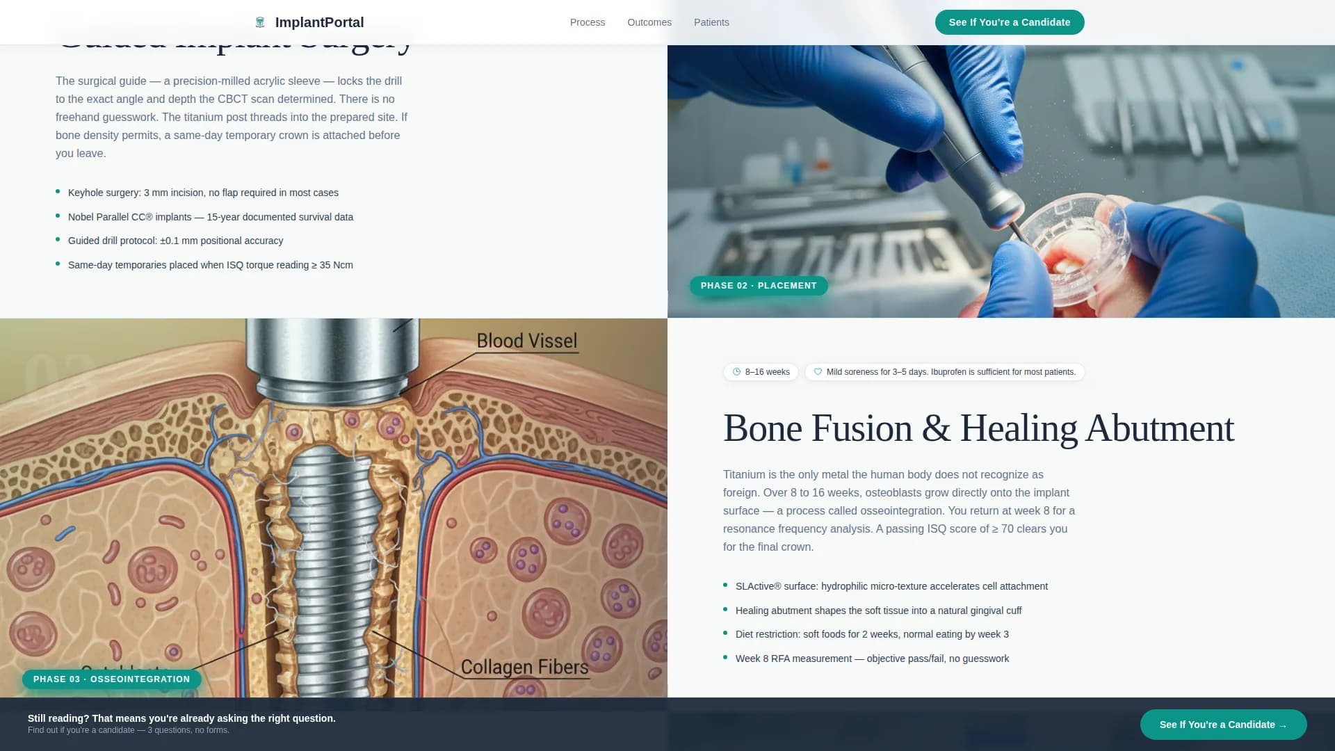 Implant - Consultation Landing Page Template