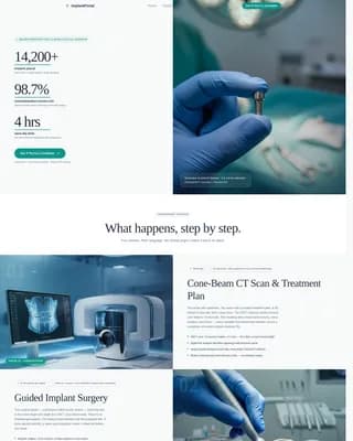 Implant - Consultation Landing Page Template