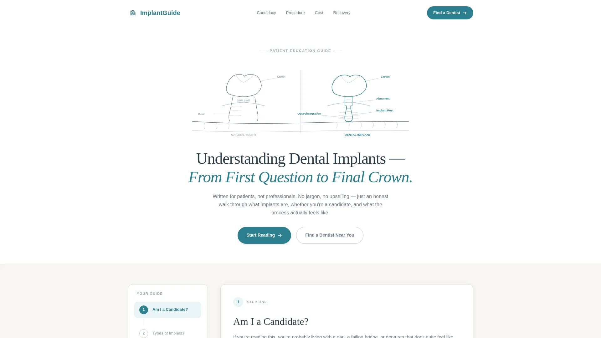 Implant - Provider Directory Landing Page Template