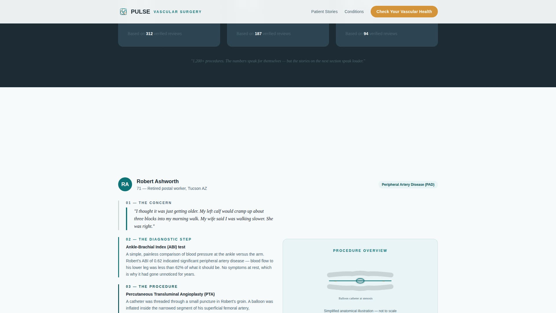 Pulse - Trusted Vascular Landing Page Template