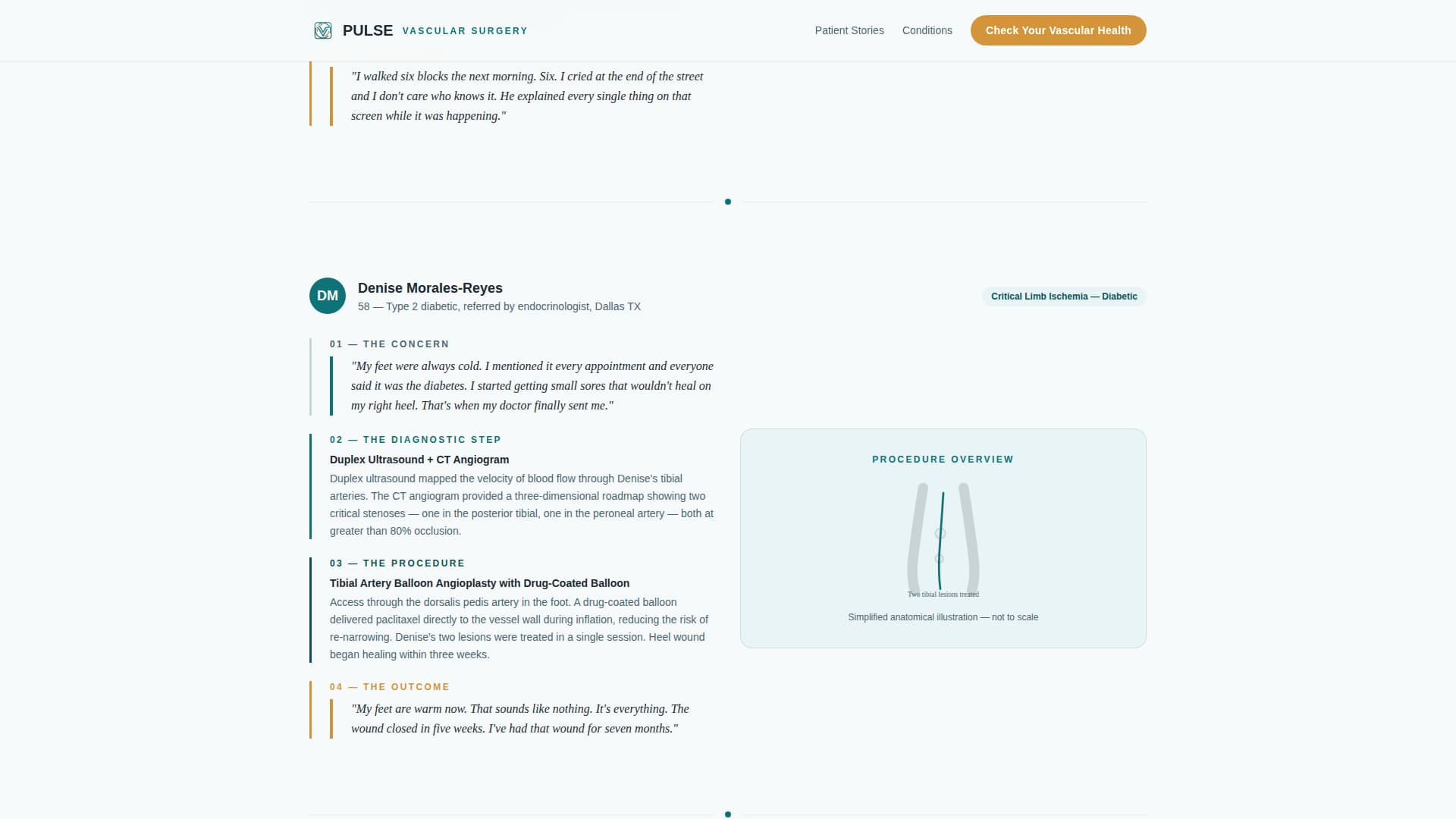 Pulse - Trusted Vascular Landing Page Template