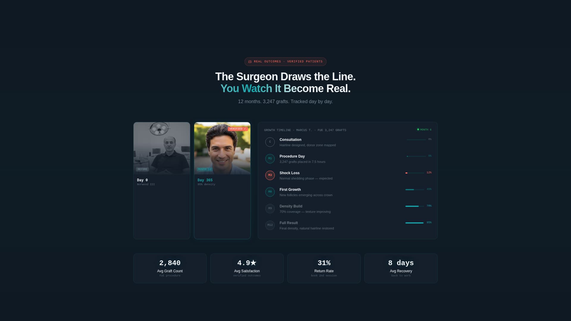 Graft - Precision Hairtransplant Landing Page Template