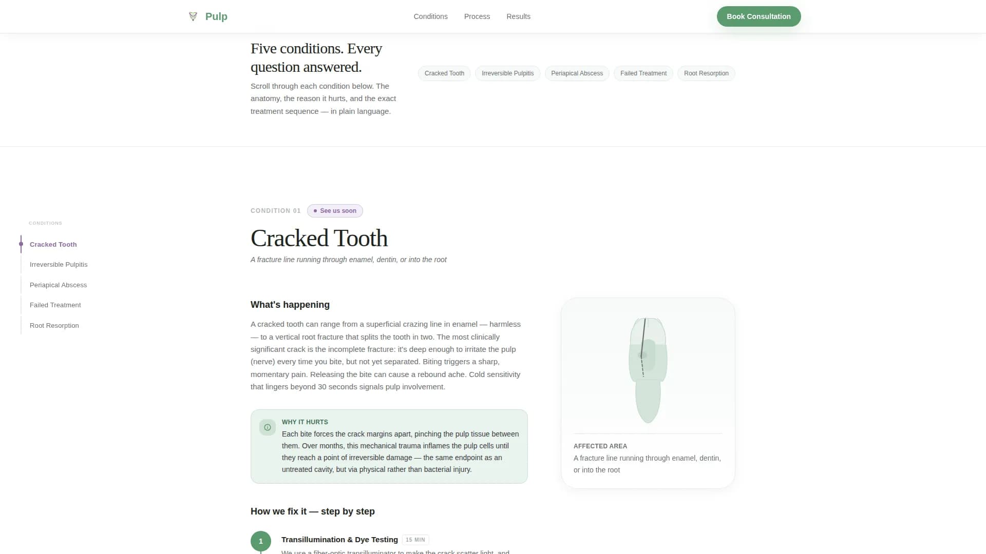 Endodontist Specialist Booking Website Template