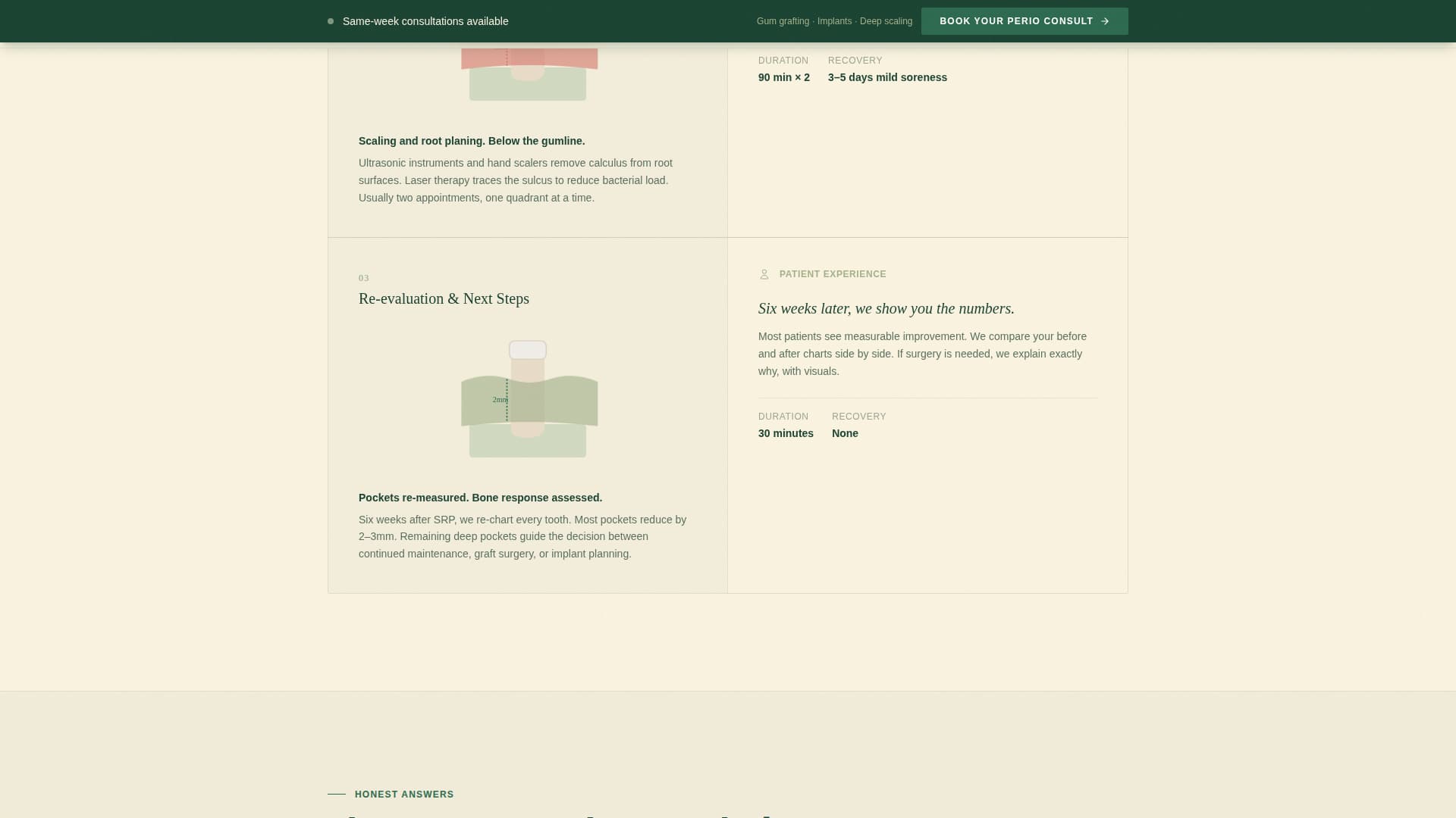 Perio - Trusted Periodontist Landing Page Template