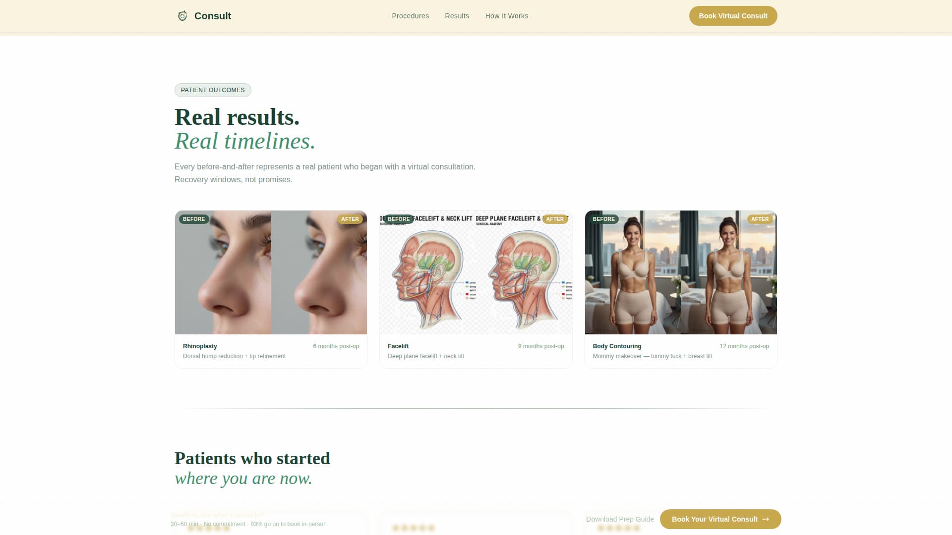 Consult - Trusted Surgeon Landing Page Template